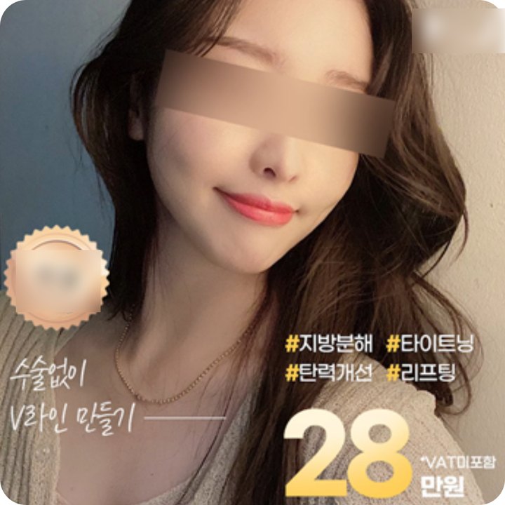 V라인 시술 가격 광고