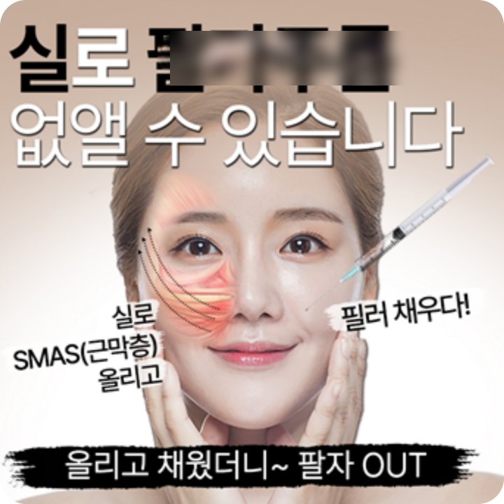 팔자주름 시술 광고